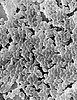 Scanning Electron Micrograph of Enterococcus