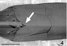 Fig. 4 ventral view of Gasteruption metasoma