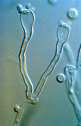 Filobasidiella (Cryptococcus) neoformans