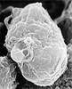 Scanning electron micrograph of human immunodeficiency virus (HIV)